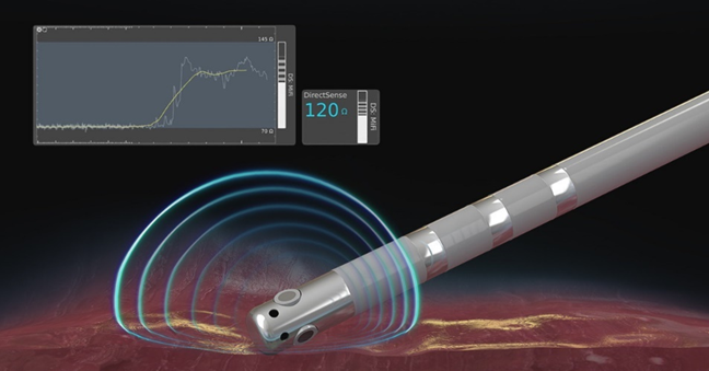 Top medical device companies: Boston Scientific's direct sense technology