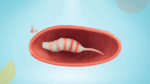 Drug delivery systems